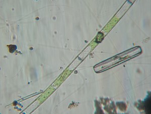 Algae and diatom